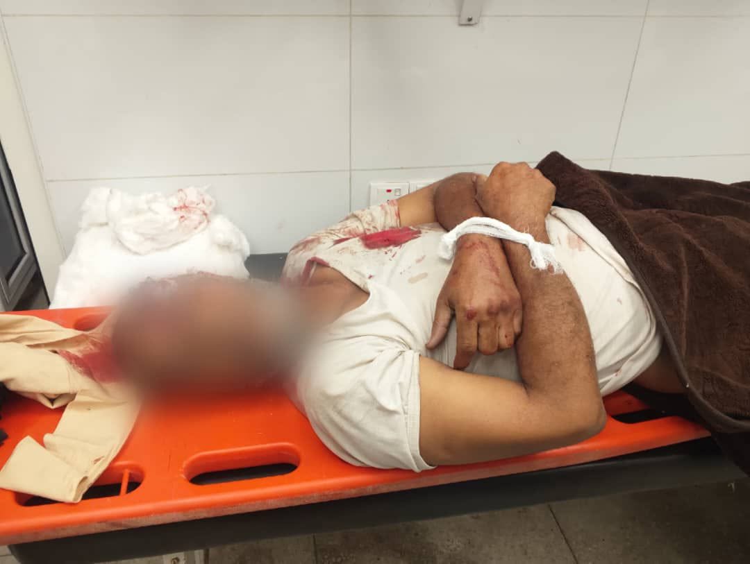 استشهاد مواطن بقصف حوثي استهدف منزله في مدينة تعز