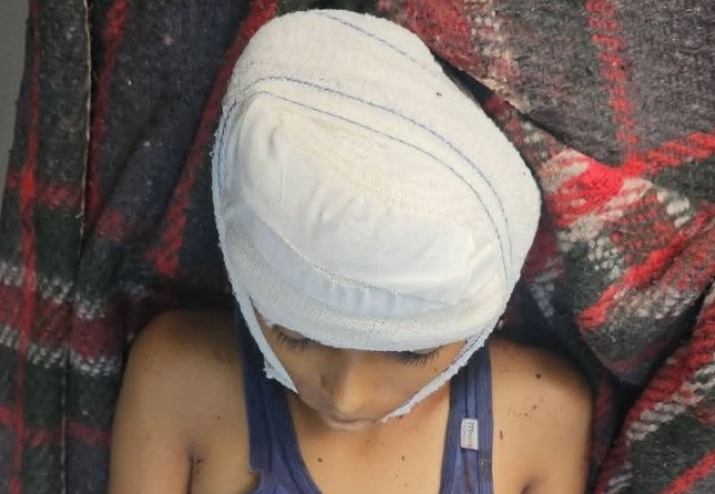 استشهاد طفل وإصابة مواطنة بقصف حوثي على حي سكني شرقي مدينة تعز