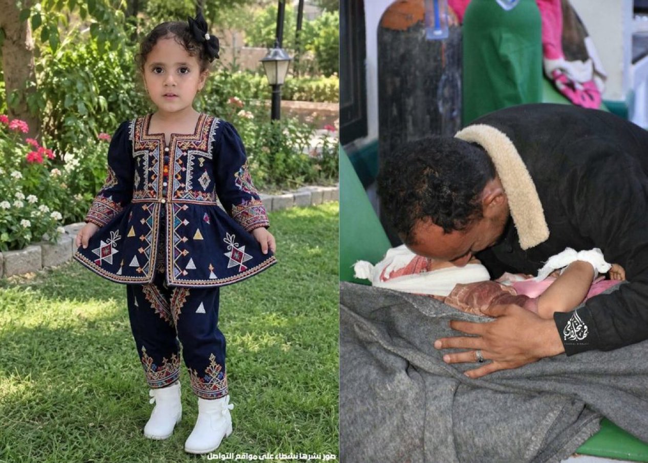 مركز حقوقي: قصف وقنص حوثي يقتل مدنيين بينهما طفلة ويصيب 16 آخرين في تعز